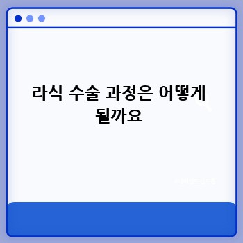 라식 수술 과정은 어떻게 될까요